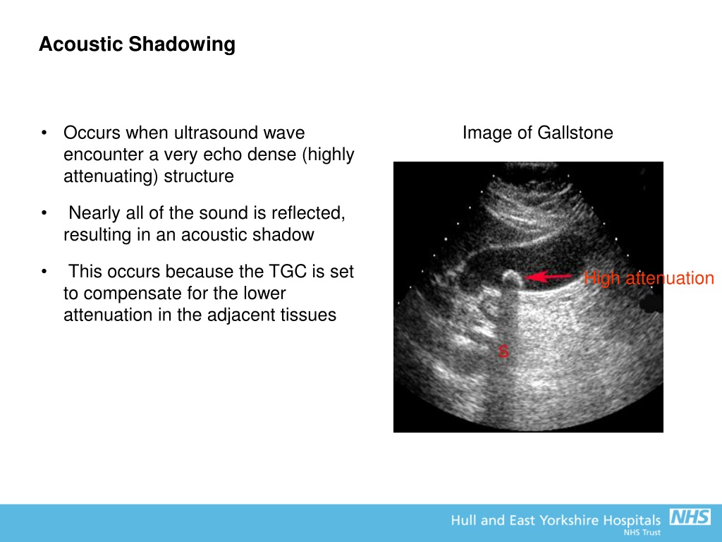 PPT - FRCR Physics Lectures The Physics Of Diagnostic Ultrasound Mark ...