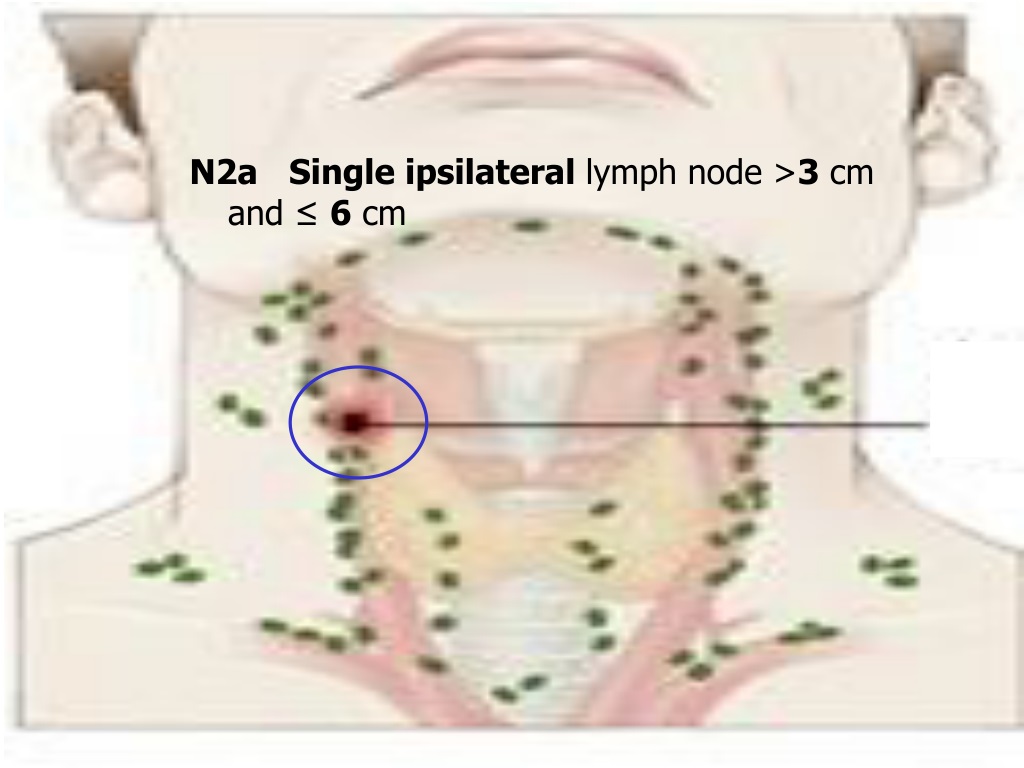 PPT - DIAGNOSIS AND MANAGEMENT OF ORAL CANCER PowerPoint Presentation ...