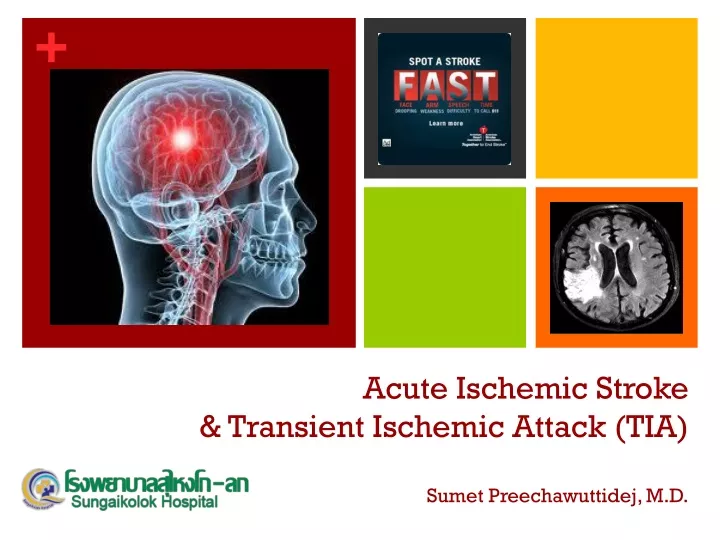 transient ischemic attack case presentation ppt