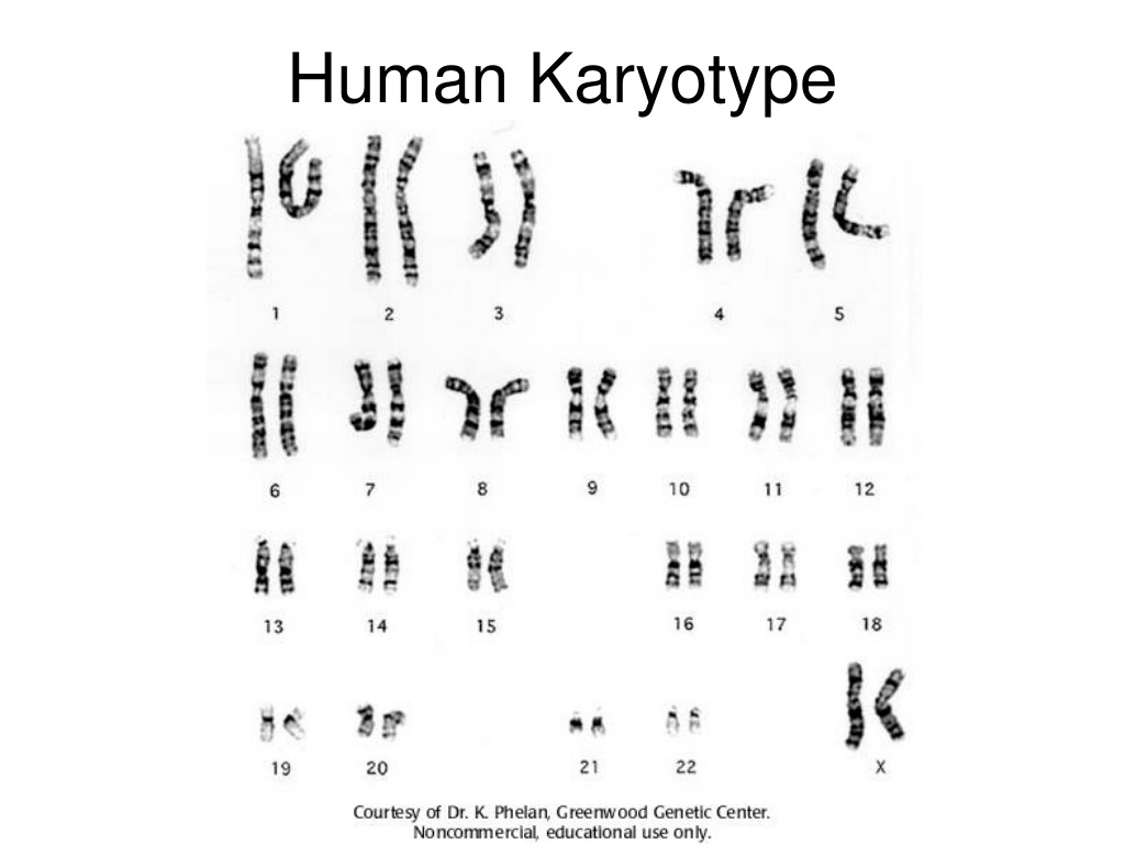 Ppt Karyotypes And Chromosomal Disorders Powerpoint Presentation Id9359221 8196