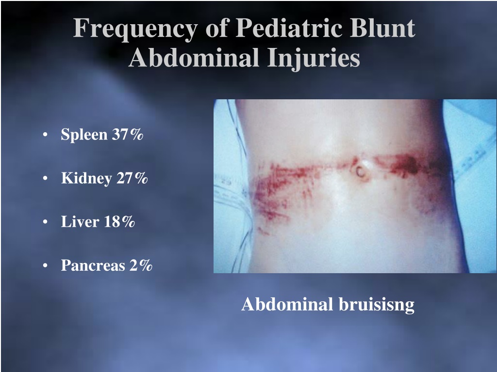 blunt abdominal trauma signs and symptoms