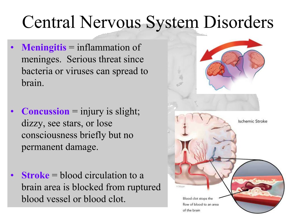 what-is-a-nervous-system-disorder