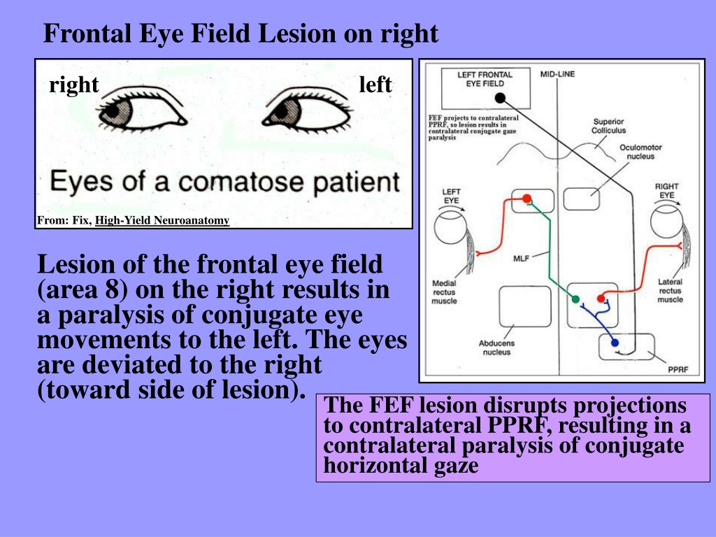 Field перевести. Frontal Eye field. Frontal Eye field gyrus атлас. Neuroanatomy High Yield.