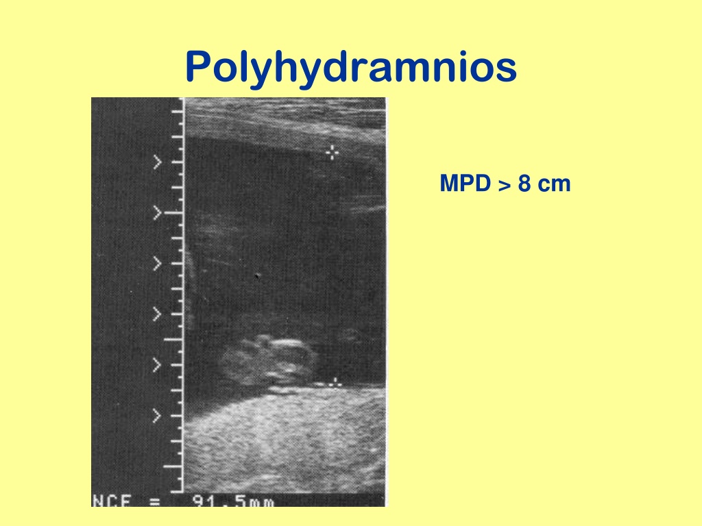 Ppt Obstetric Ultrasound Scanning Technique Powerpoint Presentation Id9397299 9877