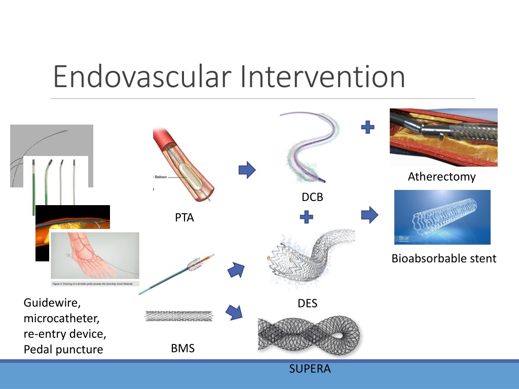 PPT - Updates On Endovascular Revascularization For Lower Limb ...