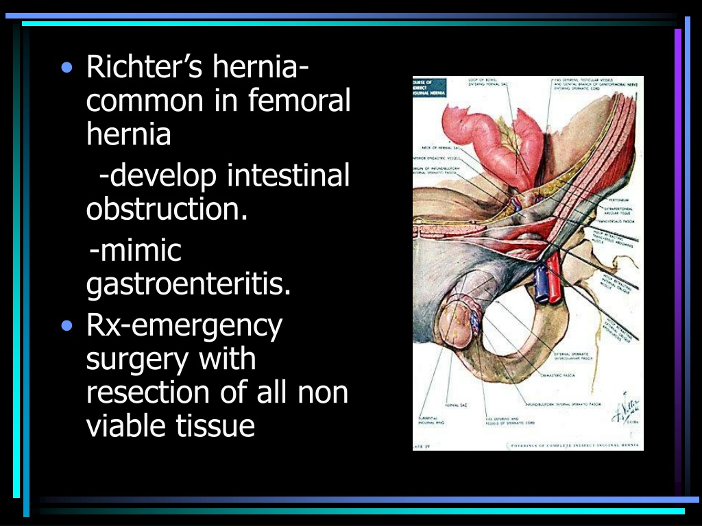 hernia presentation