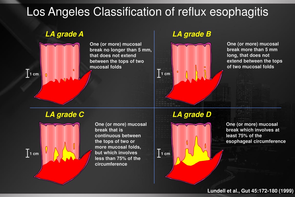 Classificação De Los Angeles - RETOEDU