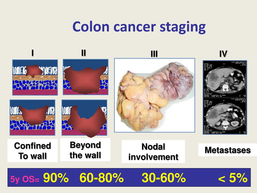 PPT - COMMON SOLID TUMORS PowerPoint Presentation, free download - ID ...