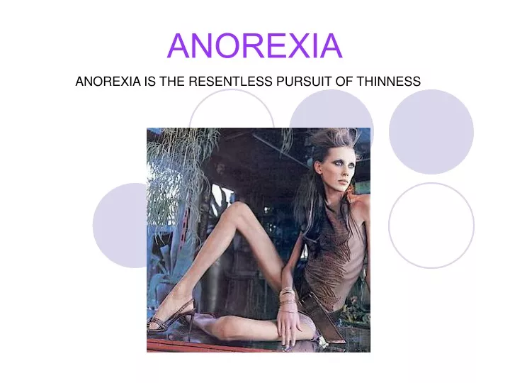 PPT - ANOREXIA PowerPoint Presentation, free download - ID:9441516