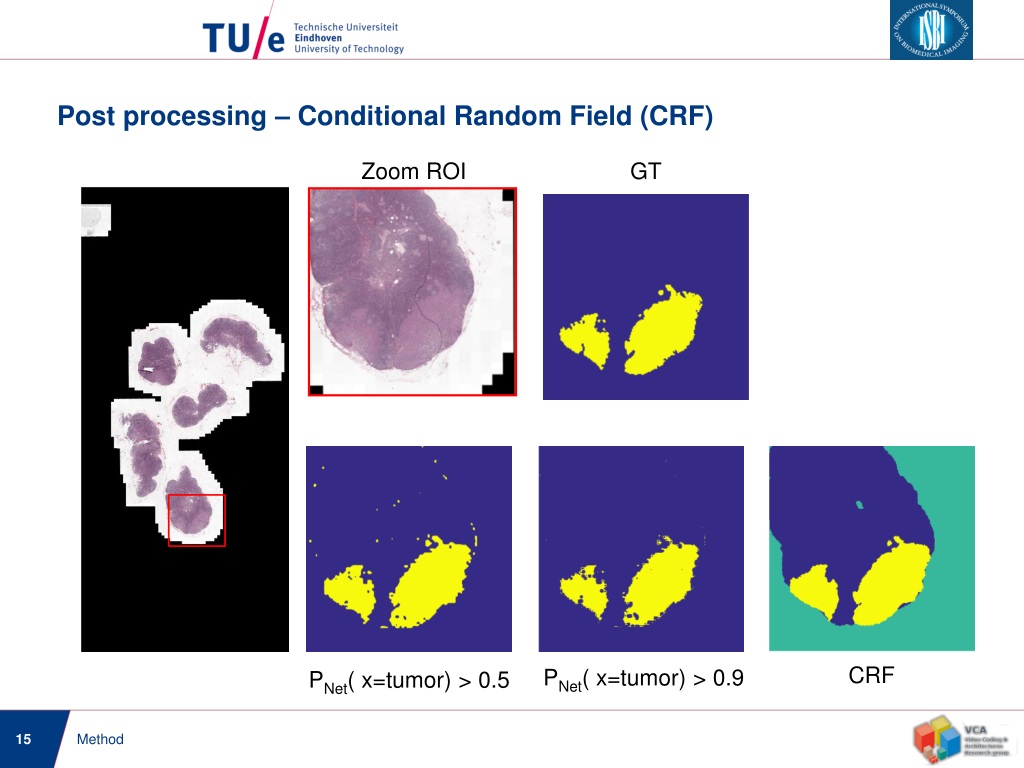 ppt-cancer-metastases-classification-in-histological-whole-slide