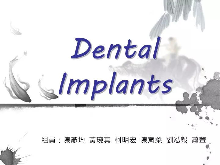 dental implants n.