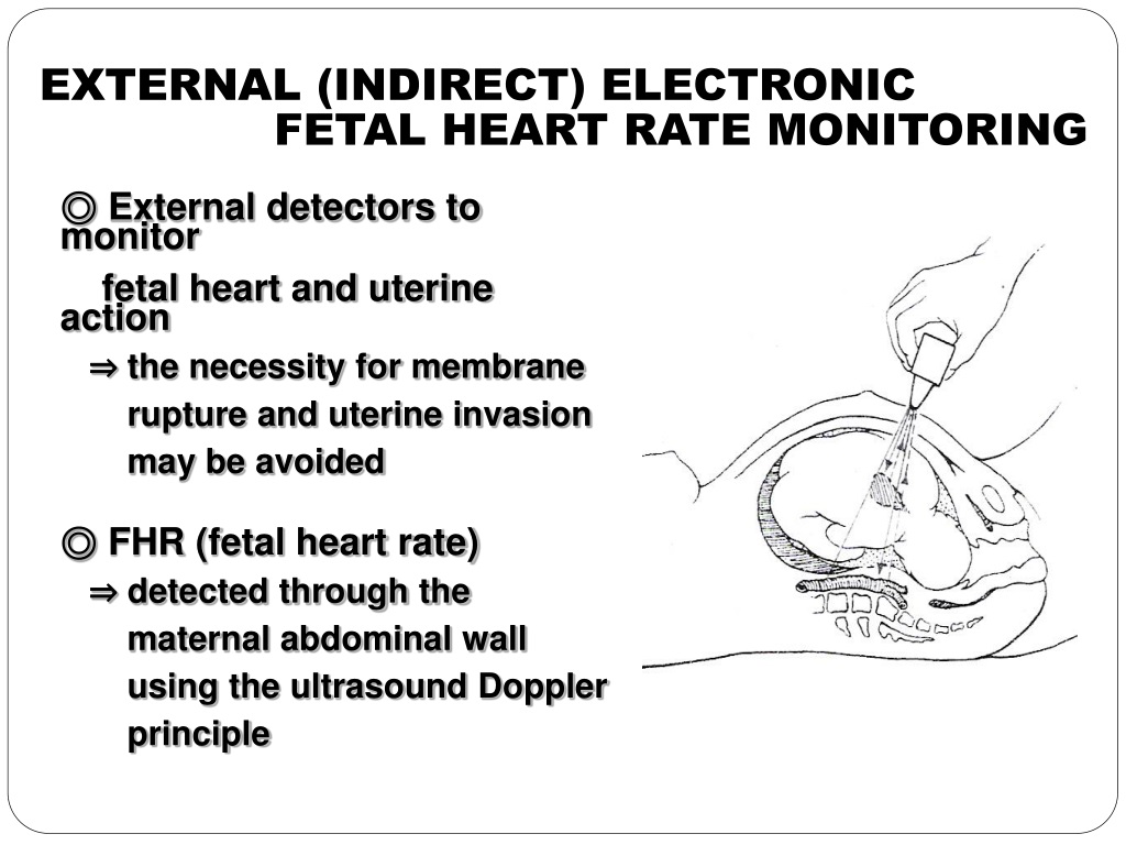 PPT - Fetal Assessment PowerPoint Presentation, free download - ID:9461357