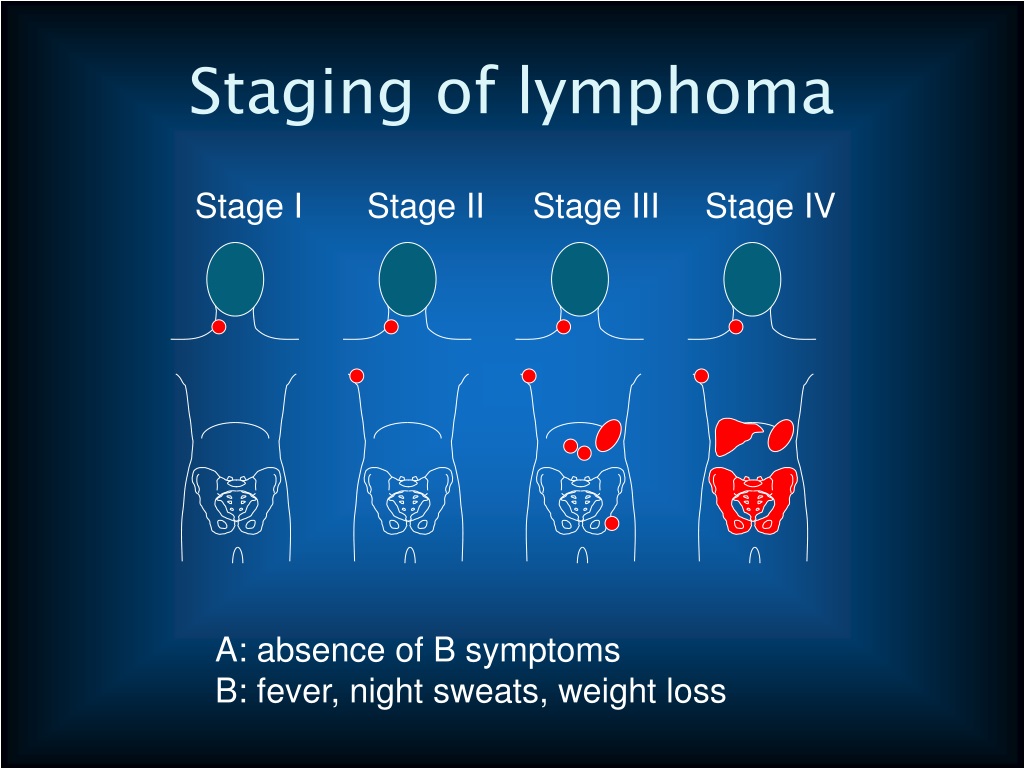 typical presentation of lymphoma