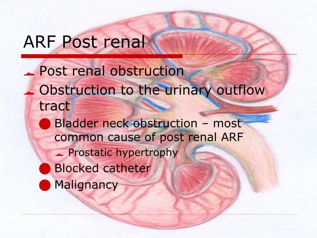 PPT - Acute Renal Failure PowerPoint Presentation, free download - ID ...