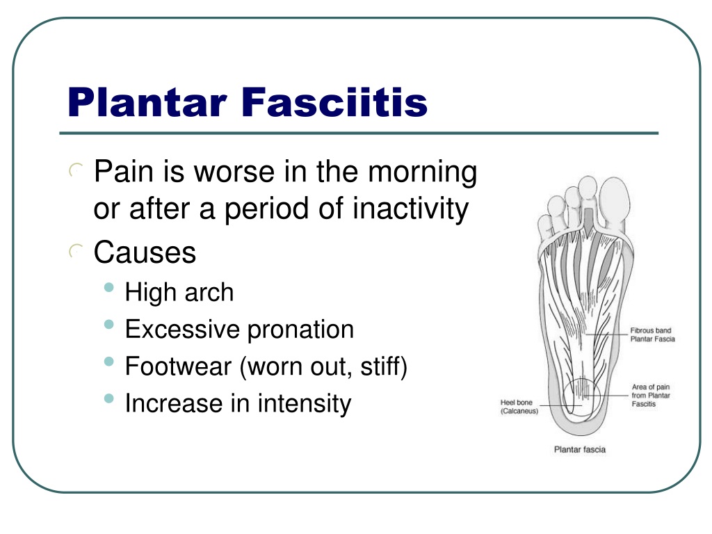 Plantar fasciitis popping sound information