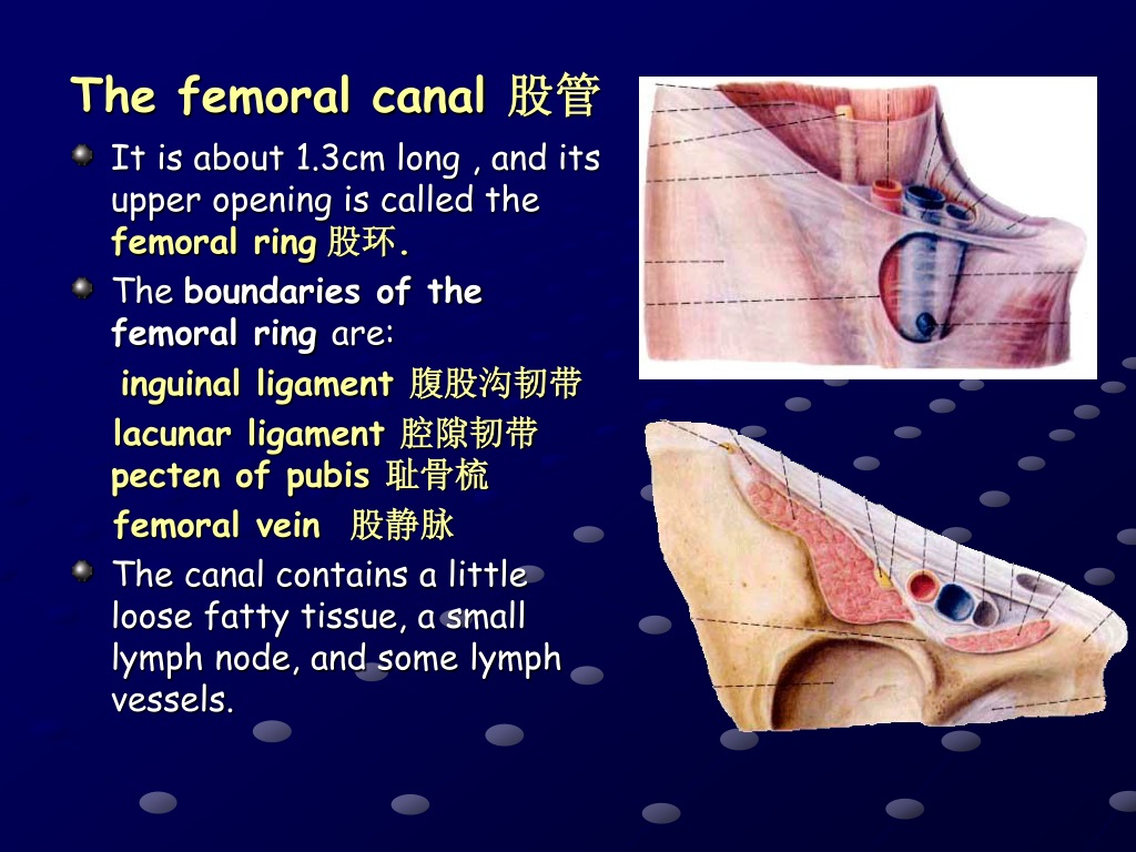 FEMORAL TRIANGLE & FEMORAL HERNIA - ppt download