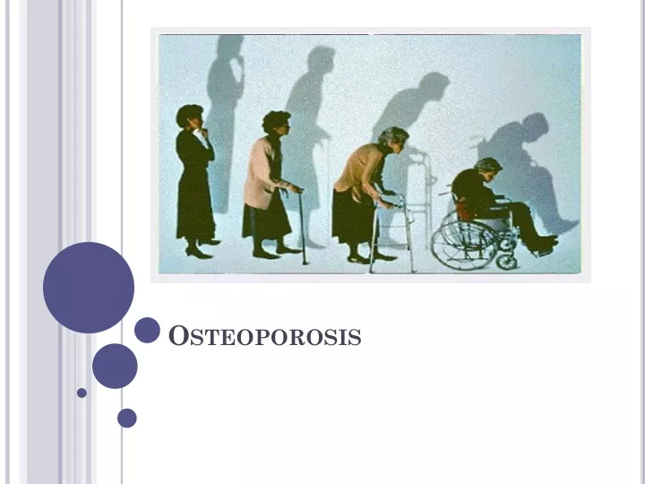 PPT Osteoporosis PowerPoint Presentation Free Download ID 9507623