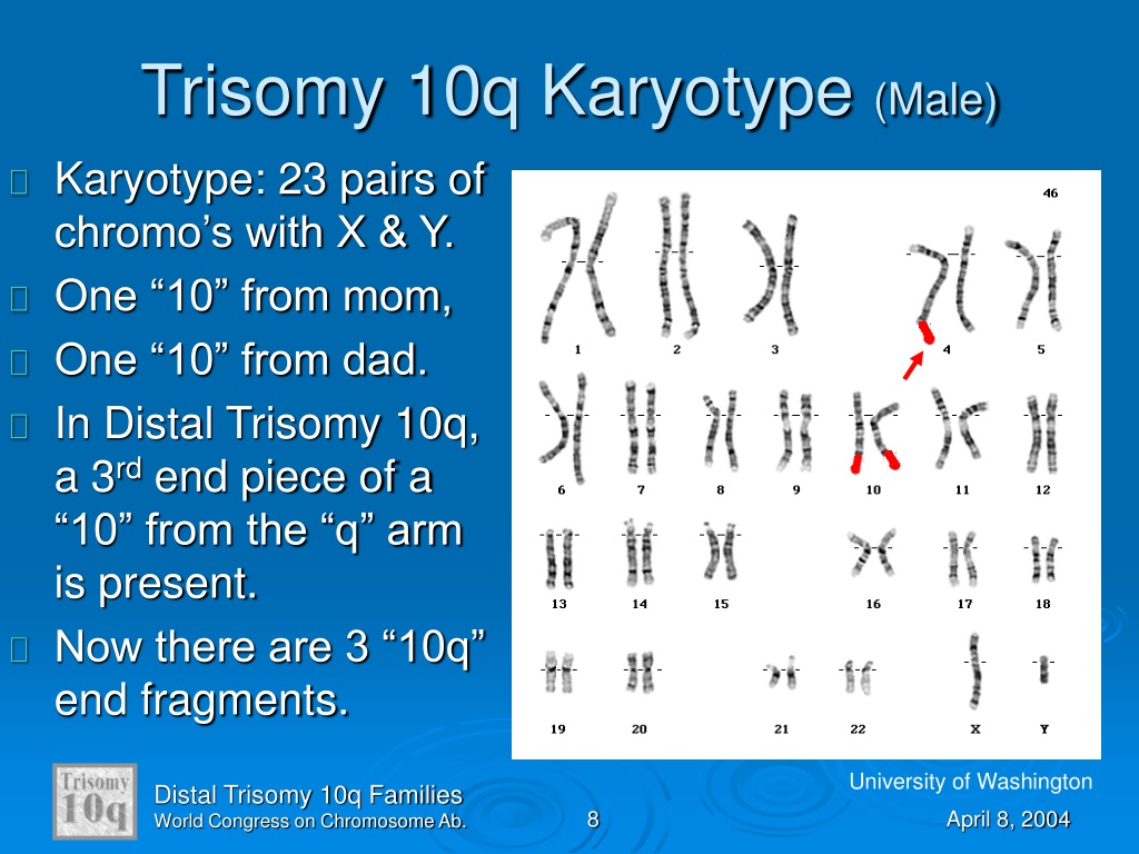 PPT - An Overview of Distal Trisomy 10q PowerPoint Presentation, free ...