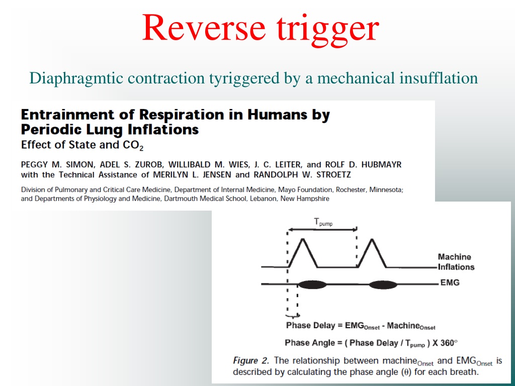 PPT - Roberta Costa MD Istituto Di Anestesiologia E Rianimazione Ventil ...