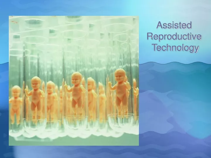 Ppt Assisted Reproductive Technology Powerpoint Presentation Free Download Id9527483 6387