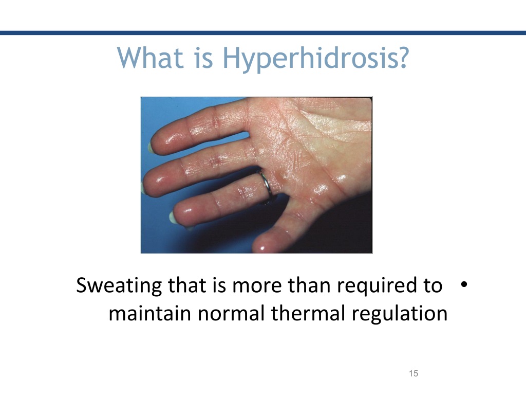 Ppt Understanding Hyperhidrosis Causes Types And Treatment Options