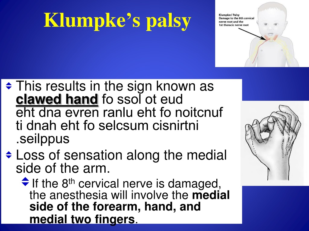 PPT - Brachial Plexus + Vascular Supply PowerPoint Presentation, free ...