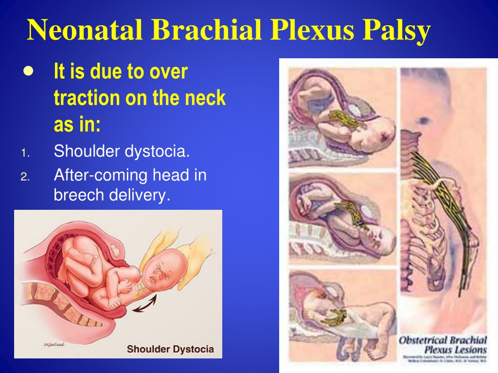 PPT - Brachial Plexus + Vascular Supply PowerPoint Presentation, free ...