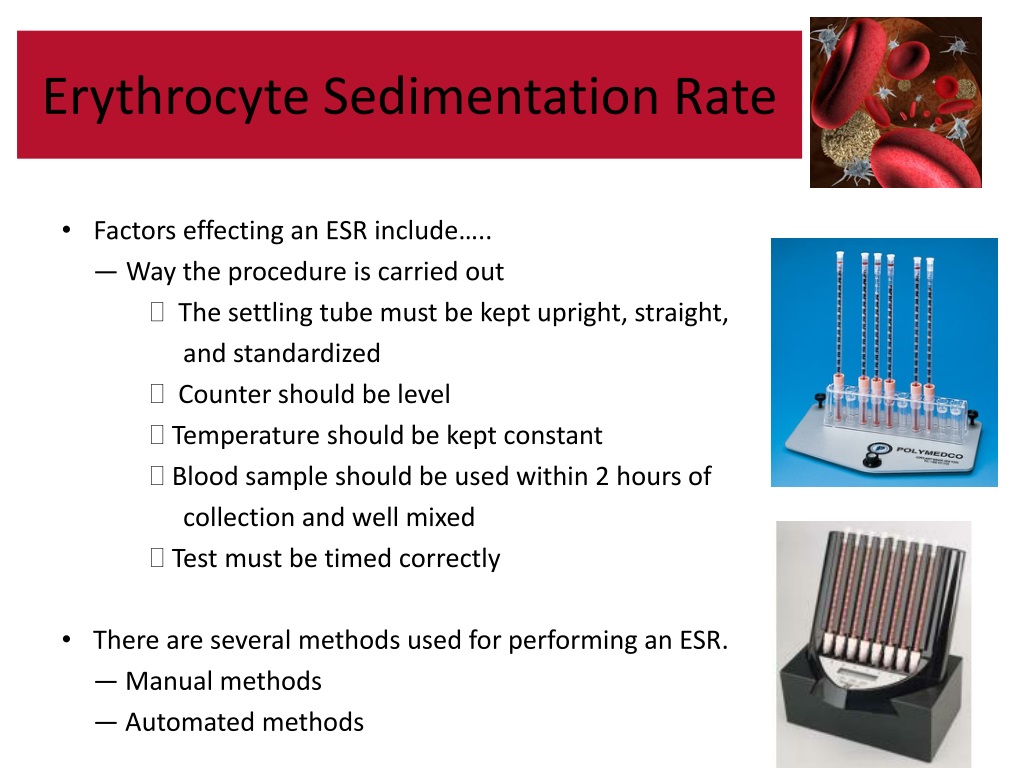 erythrocyte-sedimentation-rate-esr-blood-test-uses-results