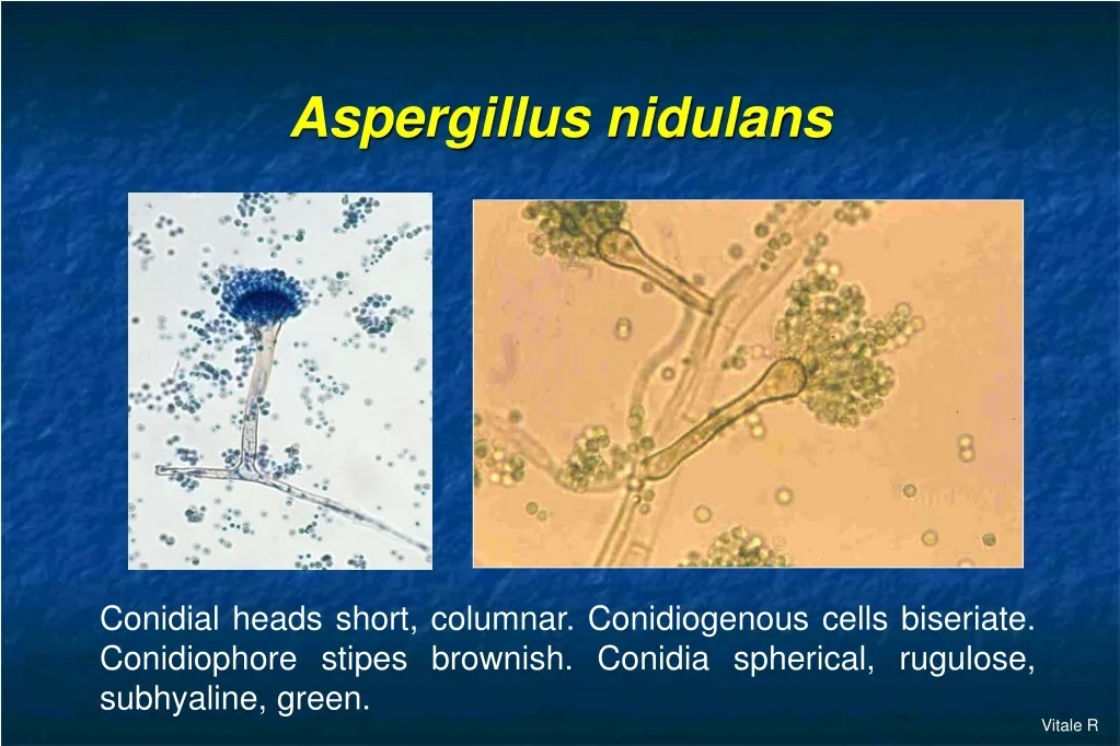 PPT Aspergillus Diagnostic Methods Classic Techniques From Dr 