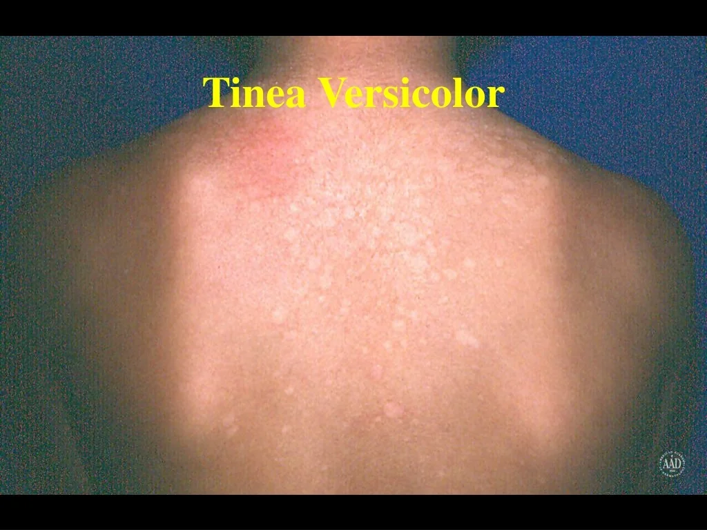 PPT Dermatological Conditions Overview PowerPoint Presentation Free PPT Dermatological Conditions Overview PowerPoint Presentation Free
