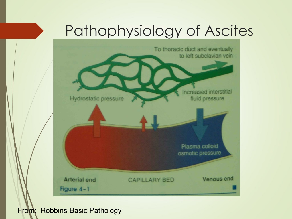 case study on ascites ppt