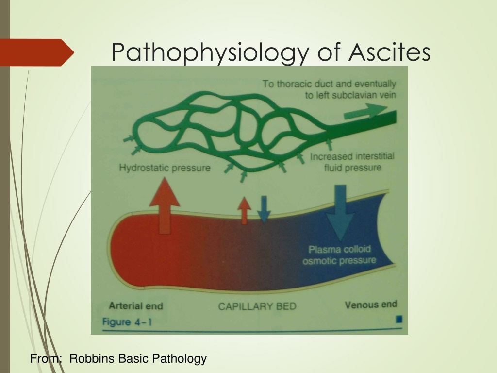 case presentation of ascites ppt