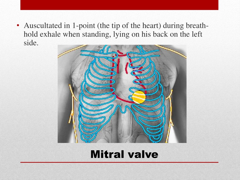 PPT - “ Symptoms and syndromes based on the data of auscultation of a ...