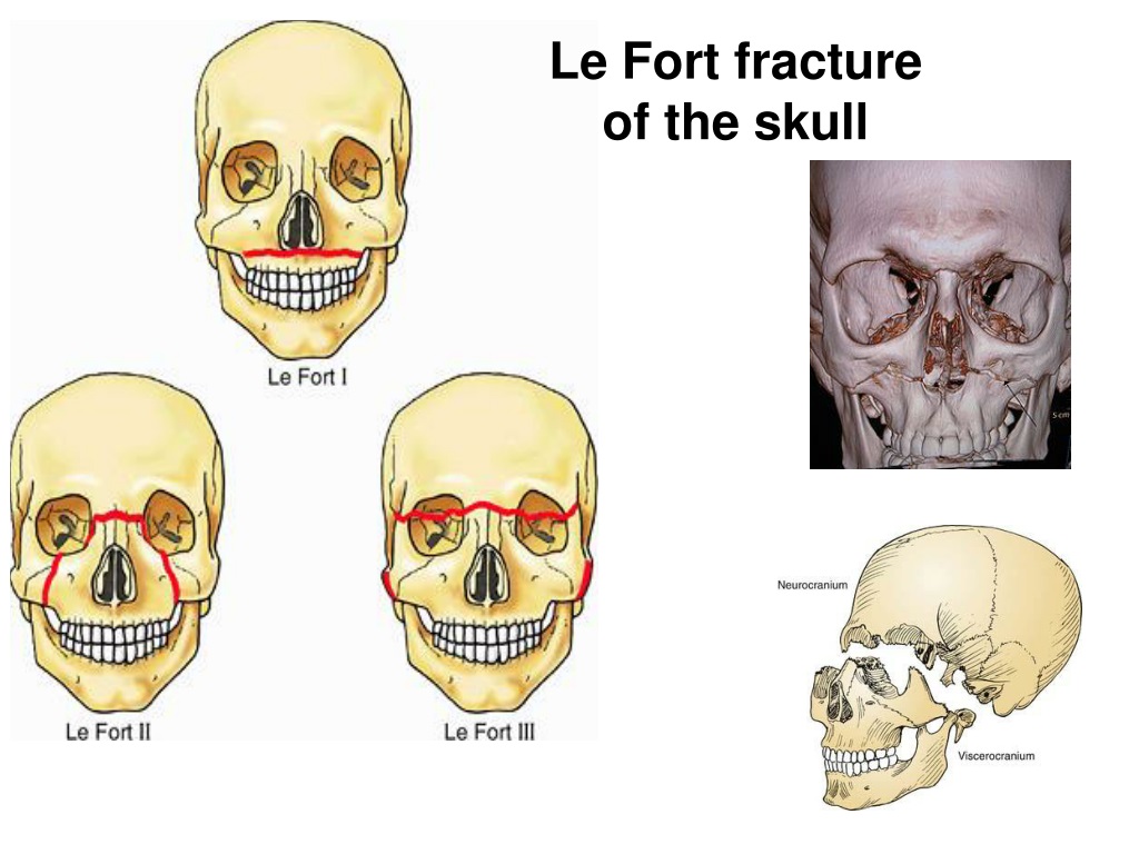 PPT - Introduction, the composition and development of the skull ...