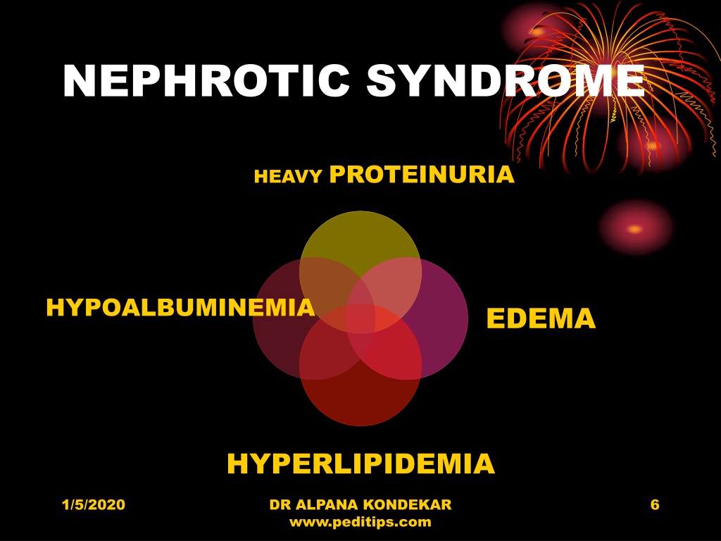 presentation in nephrotic syndrome