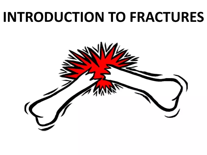 PPT - INTRODUCTION TO FRACTURES PowerPoint Presentation, Free Download ...