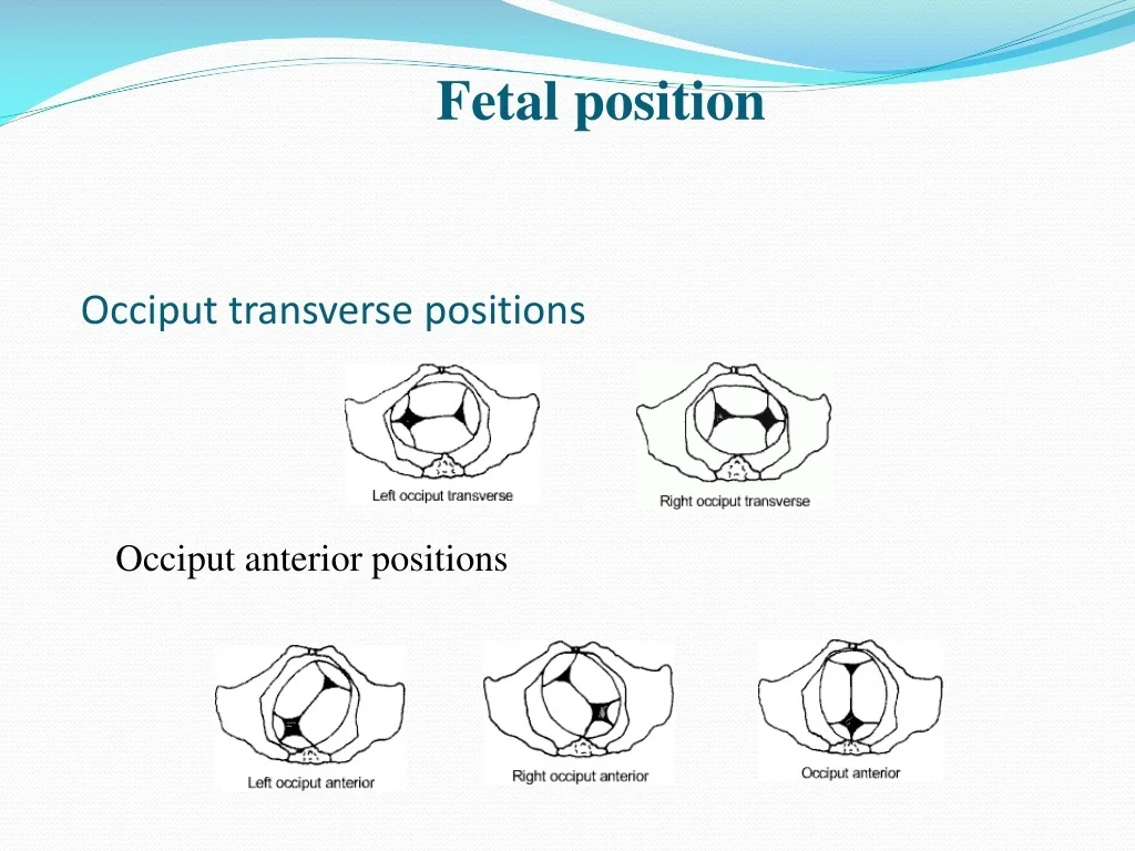 PPT Partograph PowerPoint Presentation Free Download ID 9625432