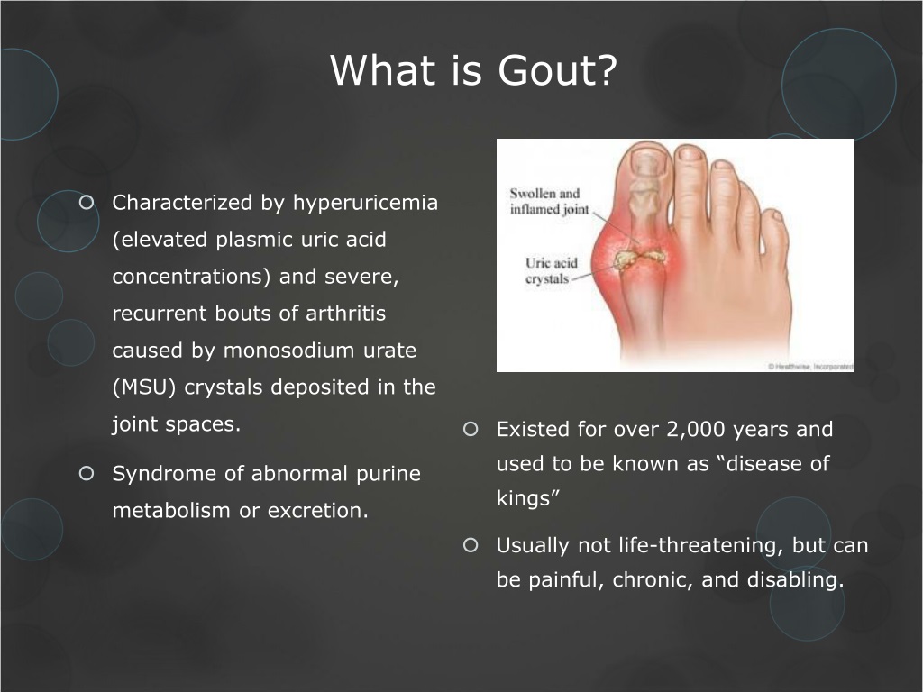 PPT - Case 77: Gout PowerPoint Presentation, free download - ID:9628891