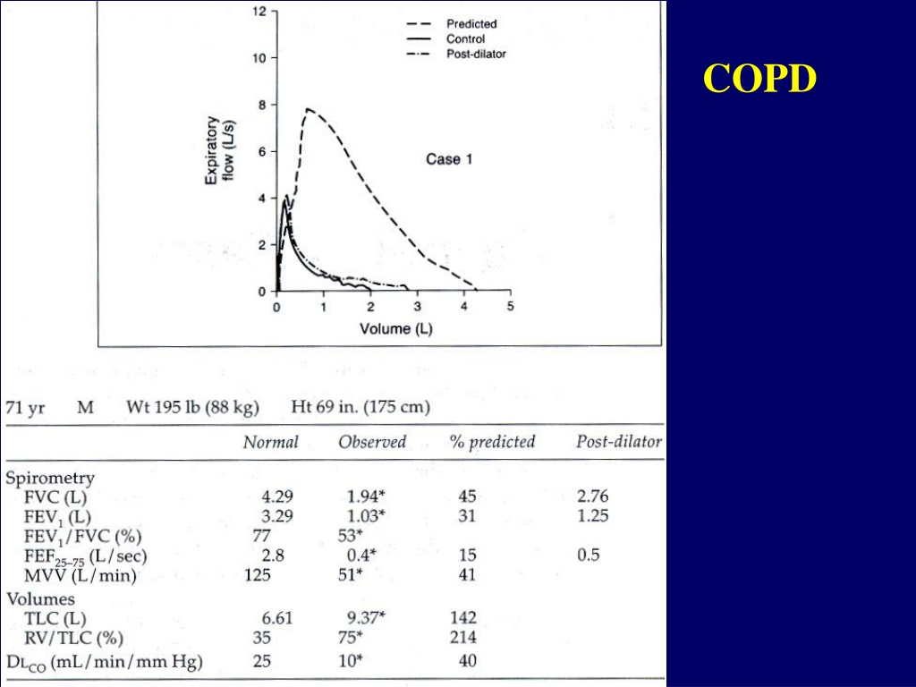 PPT - The inventor of spirometer: John Hutchinson (1846) PowerPoint ...