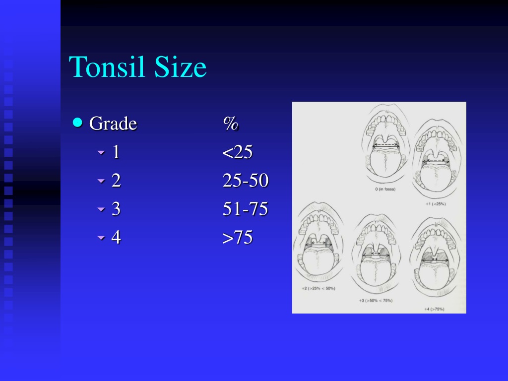 PPT Tonsillitis, Tonsillectomy and Adenoidectomy PowerPoint