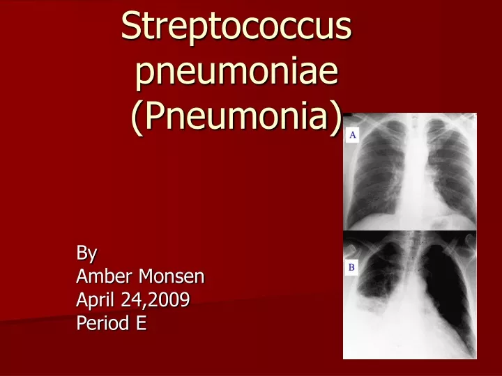 streptococcus pneumoniae pneumonia n.