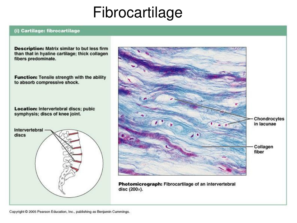 PPT - Specialized connective tissue Rigid, Elastic, Resilient - RESISTS ...