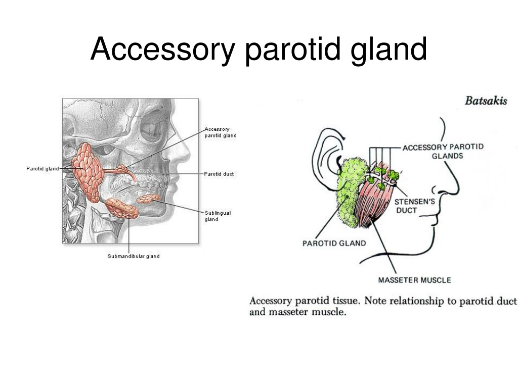 Ppt Parotid Gland Powerpoint Presentation Free Download Id9686699