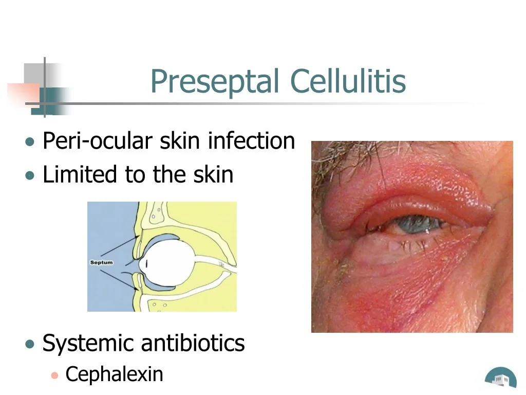 PPT Ophthalmology For Primary Care Providers PowerPoint Presentation 