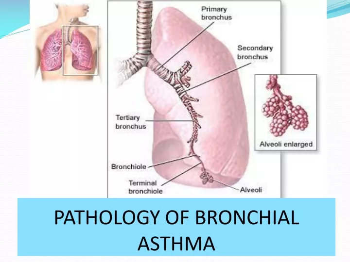 bronchial asthma powerpoint presentation