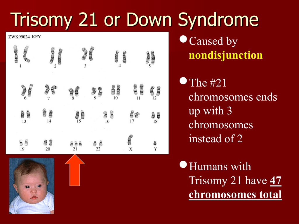 PPT - Karyotypes PowerPoint Presentation, free download - ID:9698794