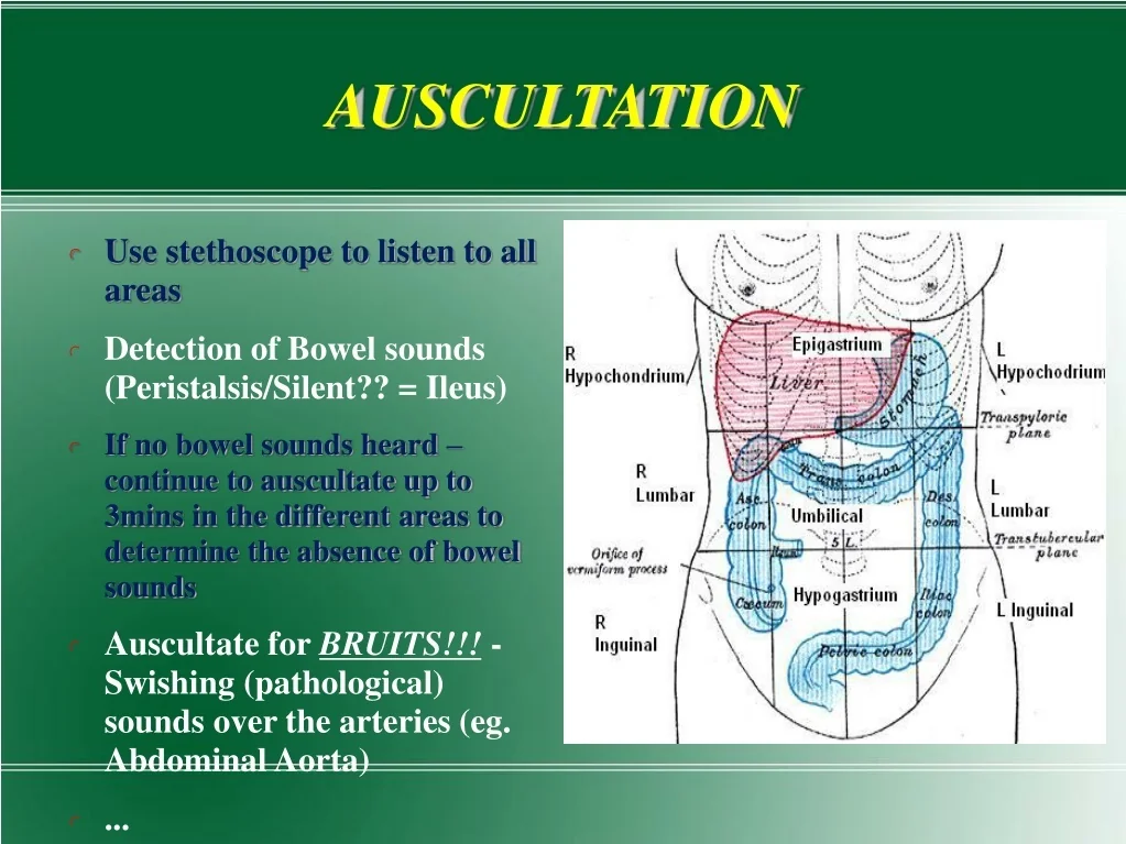 PPT ABDOMINAL EXAMINATION PowerPoint Presentation Free Download ID 