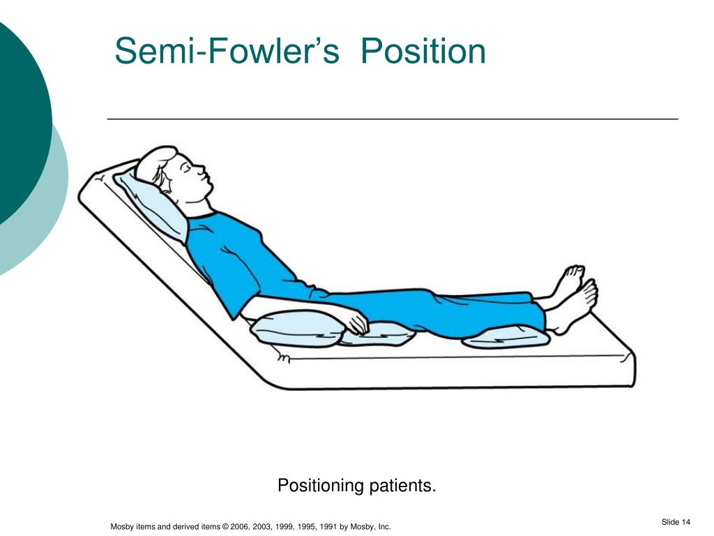 Положение фаулера. Позиция Фовлера. Semi Fowler Pozisyonu. Semi-Fowler's position.