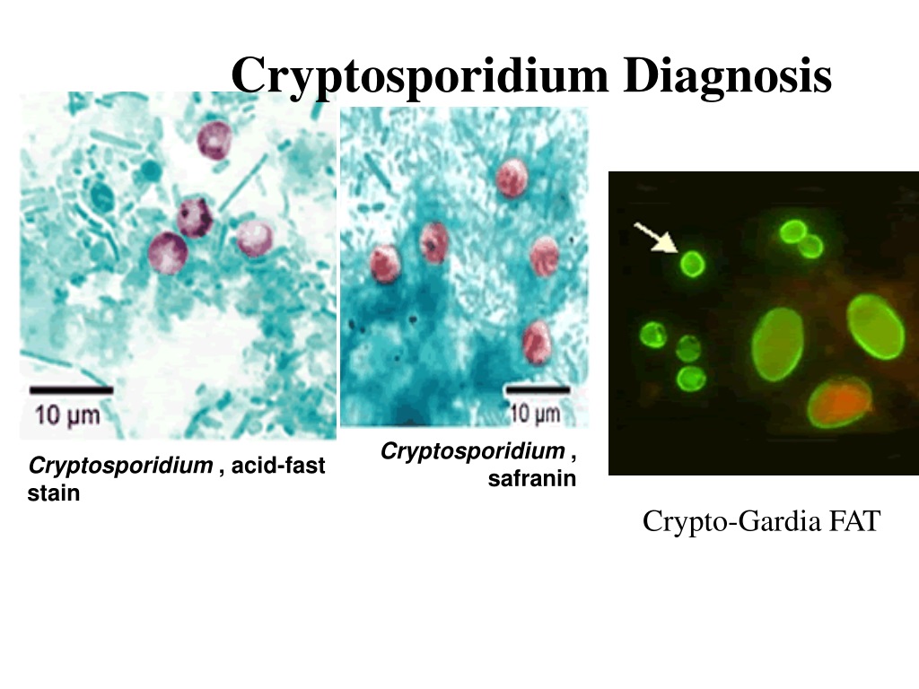 PPT - Intestinal` Protozoa PowerPoint Presentation, free download - ID ...