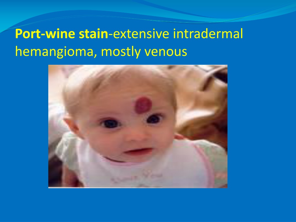 PPT - SURGICAL DISEASES DIAGNOSIS PowerPoint Presentation, free ...